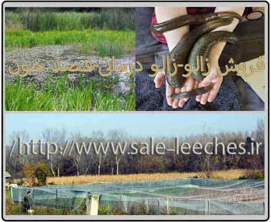 فصد خونی بهداشتی